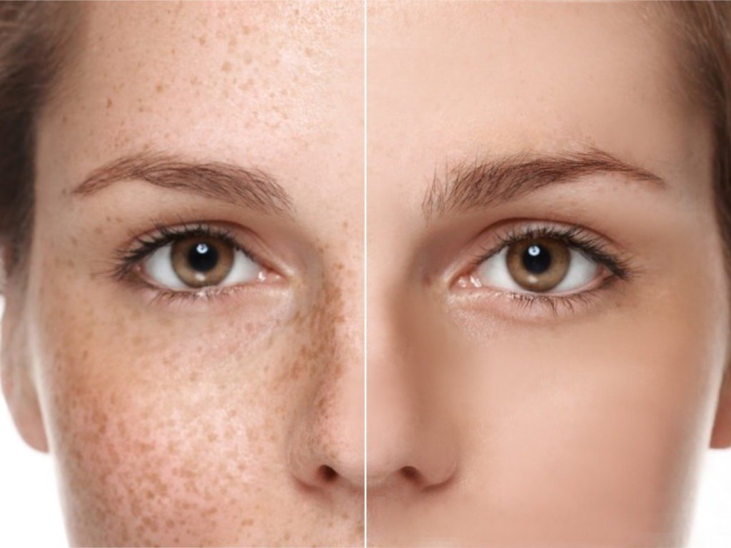 Lzvibe Whitening Beauty Cream - Image 4